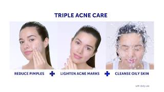 Triple Acne Care with Céleteque Acne Cleansing Stick See results in as early as 7 days [upl. by Oiliduab450]