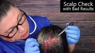 ASMR Scalp Check with Bad Results Dandruff Removal Scalp Treatment Whispering Medical Roleplay [upl. by Bullis]