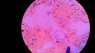 Live MicrofilariaParasite In Blood Under Microscope Captured In My Camera [upl. by Behn13]