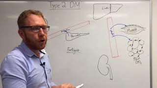 Type 2 Diabetes Pathophysiology [upl. by Meir]