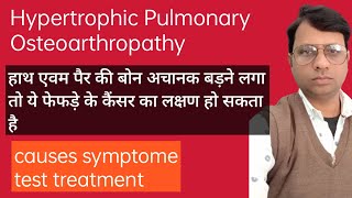 Hypertrophic pulmonary osteoarthropathy causes symptoms diagnosis Treatment pathology [upl. by Leelah]