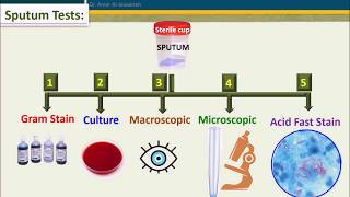 Sputum cultureWhen to reject sample [upl. by Hendry]