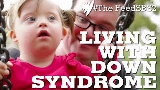 Down Syndrome Life [upl. by Adlih]