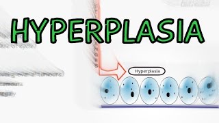 Hyperplasia  Physiological vs Pathological  Explained in 2 Minutes [upl. by Lebama966]