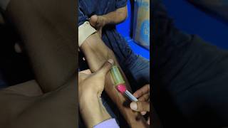 Blood sample collection vakum 💉😱pharmacy doctor trendingshorts [upl. by Vernor50]