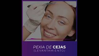 PEXIA DE CEJAS Levantamiento [upl. by Renita]