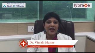 Lybrate  Dr Vimala Manne speaks on IMPORTANCE OF TREATING ACNE EARLY [upl. by Marlo]