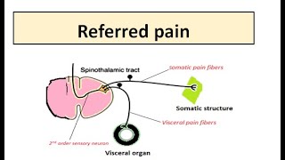 REFERRED PAIN [upl. by Seen]