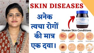 One Medicine for all Skin Diseases ॥अनेक त्वचा रोगों की मात्र एक दवा ॥ [upl. by Monreal]