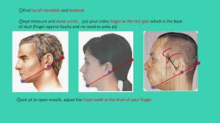 Xray odontoid view positioningopen mouth Cspine [upl. by Ecinaj]