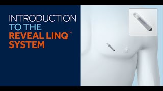 Reveal LINQ™ System Introduction for Patients [upl. by Amaty595]