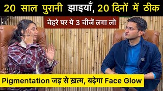 Jhaiya Khatam Karne Ka Tarika  Pigmentation treatment at home with ​⁠​⁠​⁠upasanakiduniya [upl. by Aniuqal]