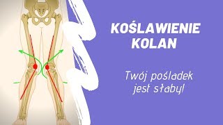 Jak wyleczyć KOŚLAWE KOLANA [upl. by Eirased]