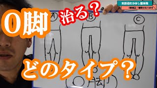 O脚のタイプ O脚にも色々ある。治る？治りにくい？ 京田辺市松井山手の「京田辺たかはし整体院」整体、産後骨盤矯正、O脚矯正 [upl. by Hurff]