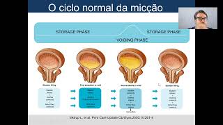 Avaliação urodinâmica [upl. by Eelime]