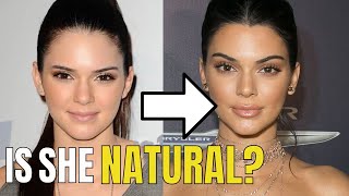 Kendall Jenner Plastic Surgery [upl. by Aiekram822]