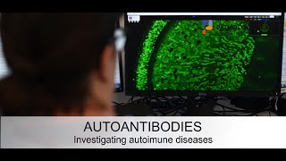 Autoantibodies investigating autoimmune diseases [upl. by Moazami]