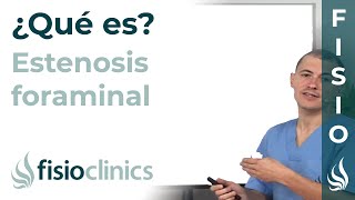 Estenosis foraminal o estrechamiento del agujero de conjunción ¿Qué es  FisioClinics Palma [upl. by Etiam]