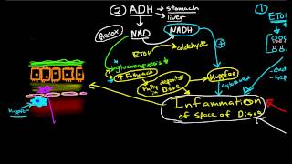 Liver repair after years of alcoholism Liver Cirrhosis Dr Nanda Rajaneesh  Doctors Circle [upl. by Enirolf438]