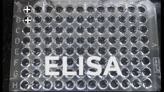 ELISA  How to do ELISA  step by step procedure for ELISA [upl. by Harrat]