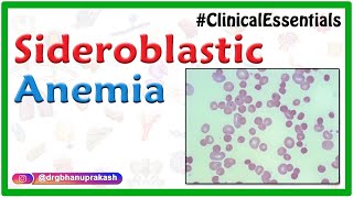 Sideroblastic Anemia  Causes Pathogenesis Clinical Presentation Diagnosis Treatment [upl. by Enybor582]