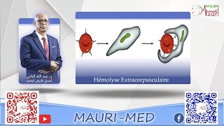 Hématologie  Anémies hémolytiques extracorpusculaires [upl. by Hardner684]