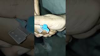 Easy pass I v cannula 22 size youtuberyoutubeshortsyoutubeytshortyoutubevideoyoutubevideos [upl. by Olinad]