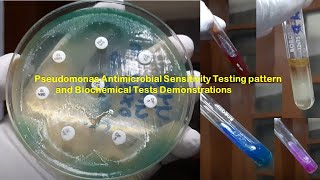 Pseudomonas Antimicrobial Sensitivity Testing pattern and Biochemical Tests Demonstrations [upl. by Eustazio30]