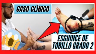 Rehabilitación ESGUINCE DE TOBILLO Grado 2 CASO CLÍNICO  MAL CURADO 🤯  TRATAMIENTO VENDAJE [upl. by Eaves578]