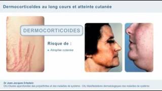 Tout savoir sur les Corticoïdes et la corticothérapie au long cours [upl. by Arondel]