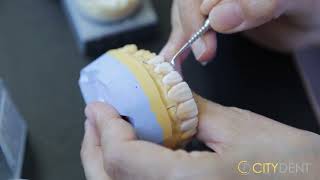 Crowns Veneers Istanbul Dental Clinic Citydent [upl. by Eupheemia]