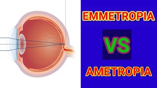 Emmetropia vs Ametropia  Atikur Rahman [upl. by Ymij948]