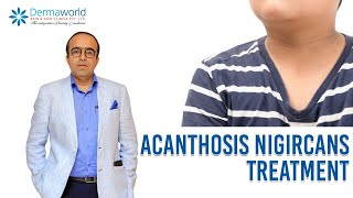 Acanthosis Nigircans Treatment  In Hindi  Dr Rohit Batra [upl. by Meraree]