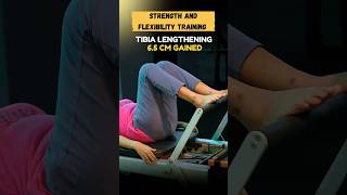 Strength and Flexibility Training  Tibia lengthening 65 cm gained [upl. by Hodge878]