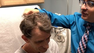 Hair Loss Treatment  Finasteride  Minoxidil  RetinA  UPDATE  Los Angeles [upl. by Dove118]