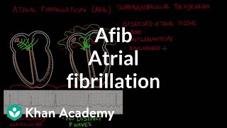 Atrial fibrillation Afib  Circulatory System and Disease  NCLEXRN  Khan Academy [upl. by Aikemehs]