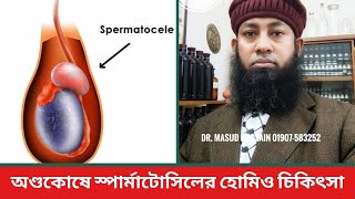 অণ্ডকোষে স্পার্মাটোসিলের হোমিও চিকিৎসা। [upl. by Vihs]