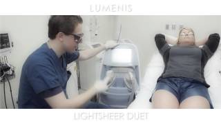 Laser Hair Removal Procedure by Lumenis Lightsheer Duet [upl. by Enilarak]