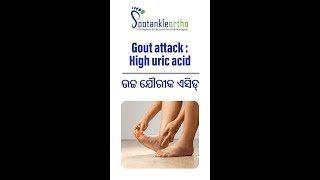 ଉଚ୍ଚ ଯୌରୀକ ଏସିଡ୍  Gout attack  High uric acid [upl. by Jahdai]