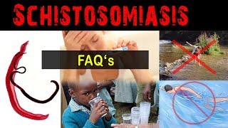 Why amp what is schistosomiasis   FAQ [upl. by Assyn46]