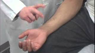 Tinels Test of the Carpal Tunnel [upl. by Jania]