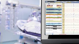 I had to take a Polysomnography test [upl. by Yarb]