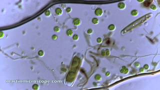 Pond Scum Under the Microscope [upl. by Salvadore]