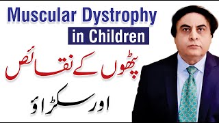 Muscular Dystrophy in Children  Diagnosis and Treatment  Dr Khalid Jamil [upl. by Connolly]