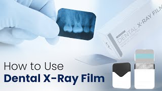 How to use Dental XRay Film  Waldent Dental XRay Film IOPA [upl. by Kevina325]