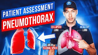 Patient Assessment Trauma  Tension Pneumothorax  EMT Skills  NREMT Review [upl. by Linden]