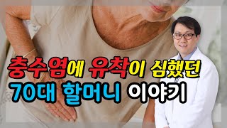 충수염에 유착이 심했던 70세 할머니 이야기 충수염 수술 맹장염 수술 맹장수술 [upl. by Whitehouse]