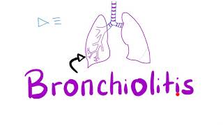 Acute Bronchiolitis Bronchiolitis ObliteransOrganizing Pneumonia BOOP  Pulmonology [upl. by Nivri]