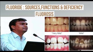 Fluoride  Sources functions deficiency and toxicity  Fluorosis  Biochemistry [upl. by Etnelav]