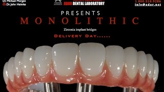 All on 4 Zirconia hybrid Implant Bridge Delivery Day infoadarnet [upl. by Michell]